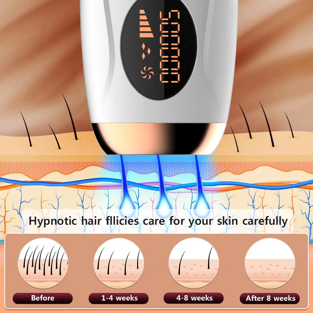 Depiladora Láser Permanente 999,999 Flashes ✨Luce una piel suave y libre de vello con esta máquina profesional de depilación láser indolora, diseñada especialmente para mujeres que buscan resultados duraderos.
