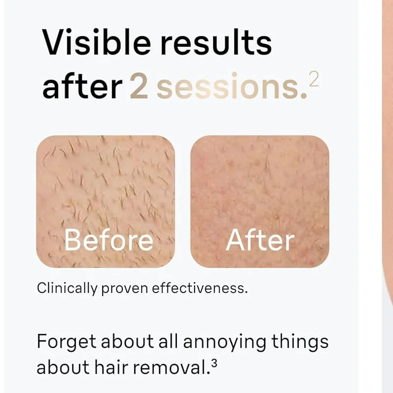 Nueva Depiladora Láser IPL Permanente 5 en 1 ✨
La solución completa para el cuidado personal. Este innovador dispositivo combina varias funciones en una sola máquina, ideal tanto para mujeres como para hombres.